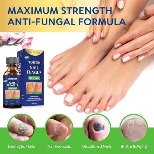 Toenail Fungus Treatment Extra Strength 30 ml Y2421