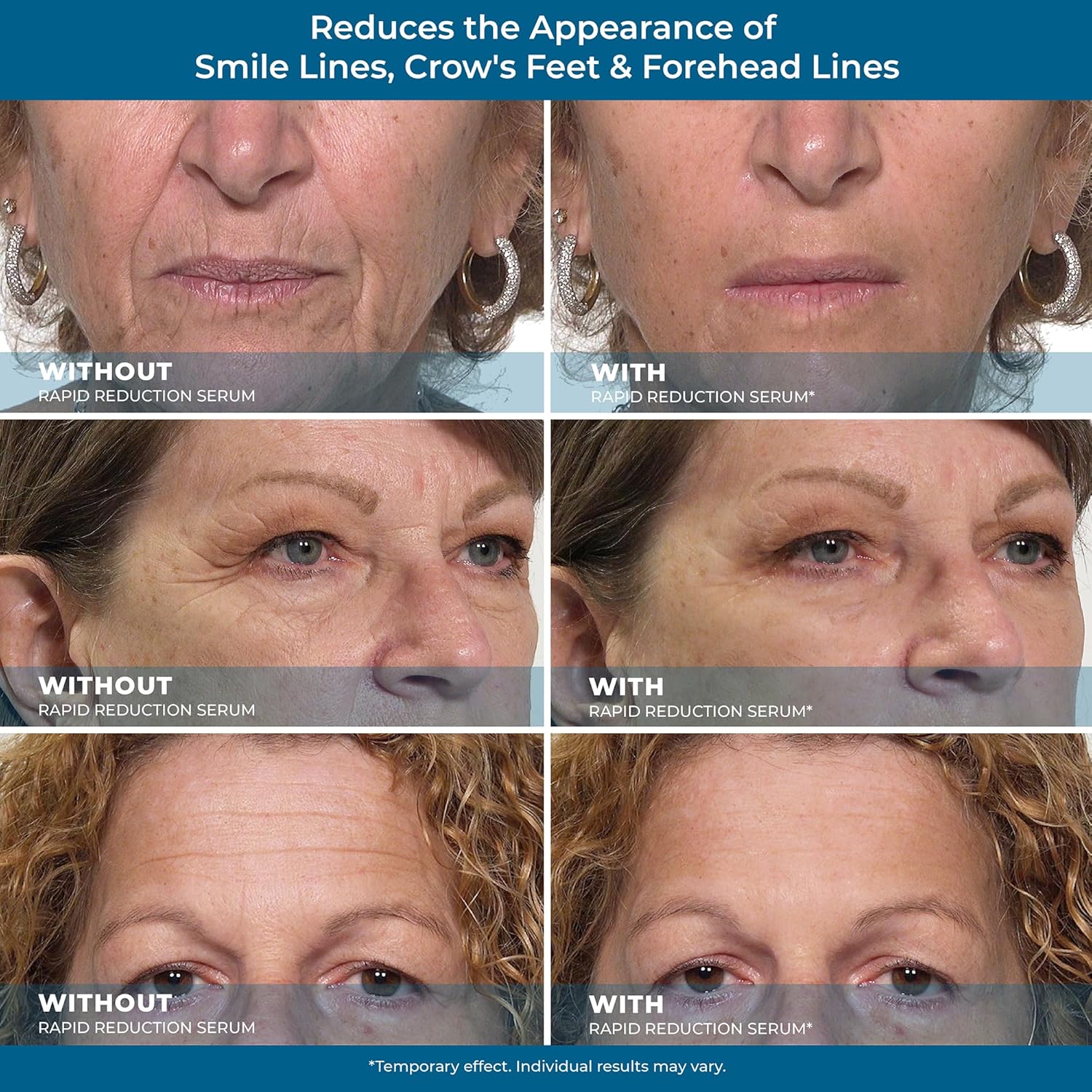 Rapid Reduction Eye Serum Pods Anti Aging Serum K538
