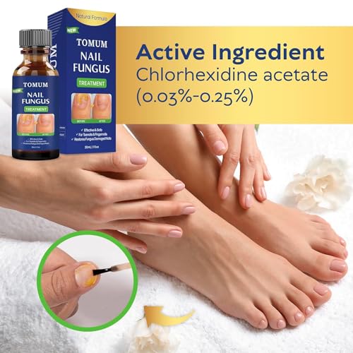 Toenail Fungus Treatment Extra Strength 30 ml Y2421