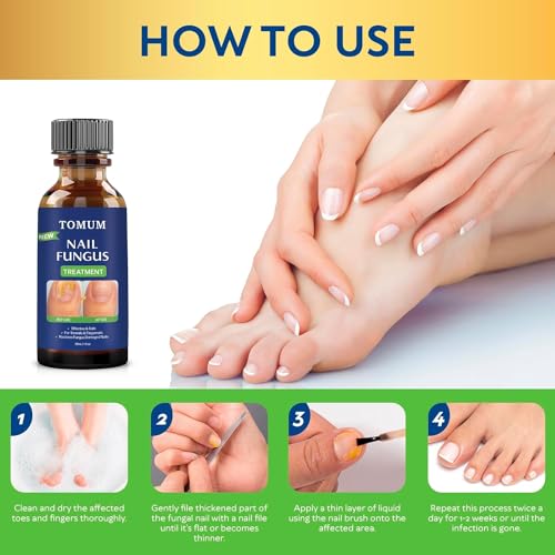 Toenail Fungus Treatment Extra Strength 30 ml Y2421